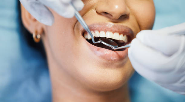 Best Urgent Tooth Repair  in Talluh, LA